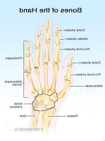 Hoe maak je een gebroken vinger te behandelen. Herken de symptomen van een gebroken vinger.