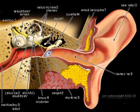 Hoe maak je een middenoor infectie te behandelen. Reinig de drainage van het oor (indien aanwezig).