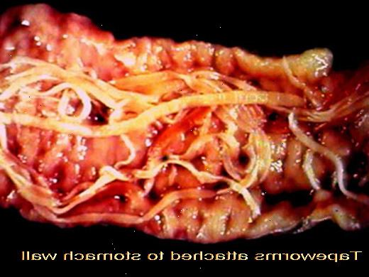 Hoe zich te ontdoen van lintwormen bij de mens. Detecteren of u besmet door lintwormen.