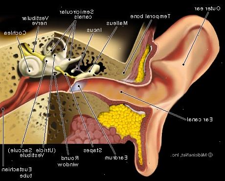 Hoe maak je een oorpijn genezen. Breng een warme over de pijnlijke oor.