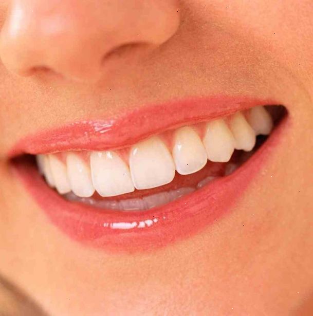 Hoe te schone, witte tanden hebben. Uw mond met koud water voor ongeveer 30 seconden om zich te ontdoen van alle losse rommel tussen je tanden te spoelen.