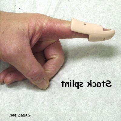 Hoe te mallet vinger te behandelen met een spalk. Houd de vinger recht.