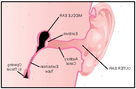 Hoe je oor ontlasten. Bepaal de oorzaak van uw oor congestie.
