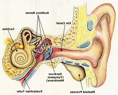 Hoe maak je een oorontsteking genezen. Diagnose de ernst van de oorontsteking.