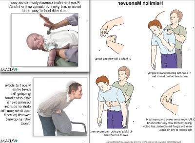 Hoe de Heimlich manoeuvre uit te voeren. Bepalen of de persoon is een verstikking slachtoffer.